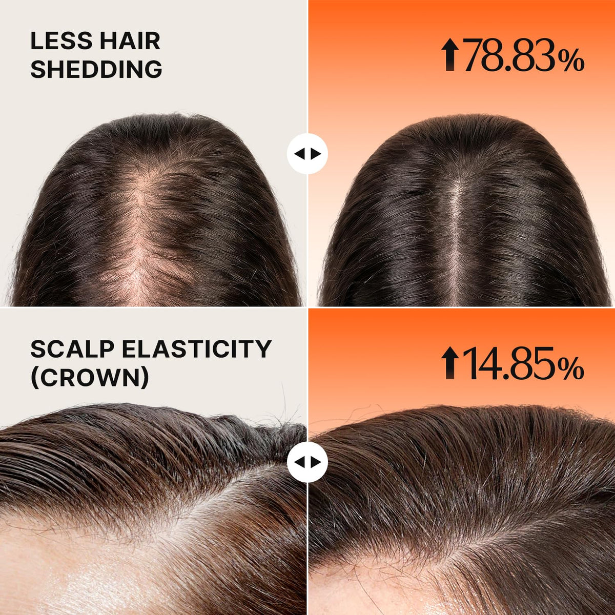 Noviera GROWTURN Hair Growth Serum with Built-in Brush