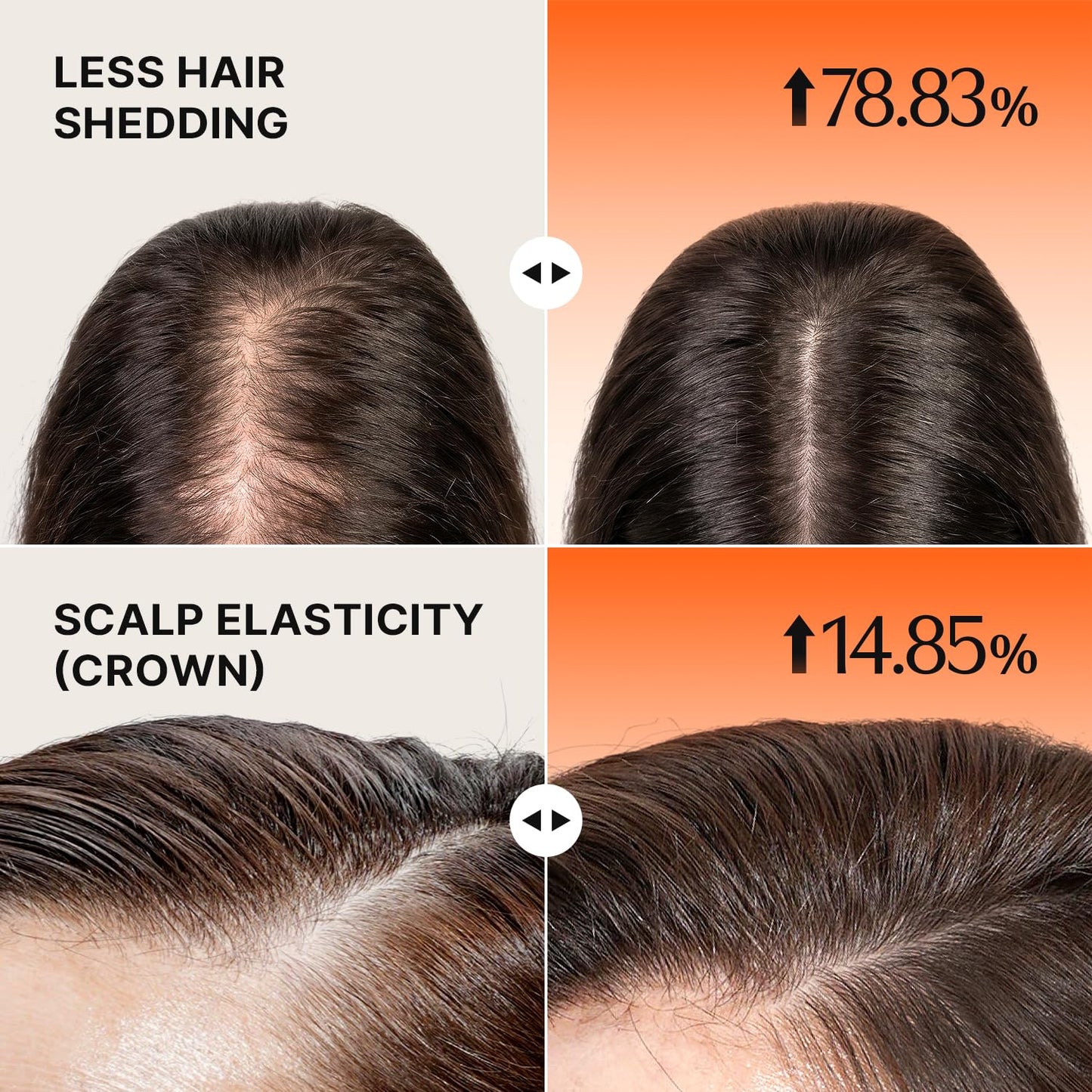 Noviera GROWTURN Hair Growth Serum with Built-in Brush